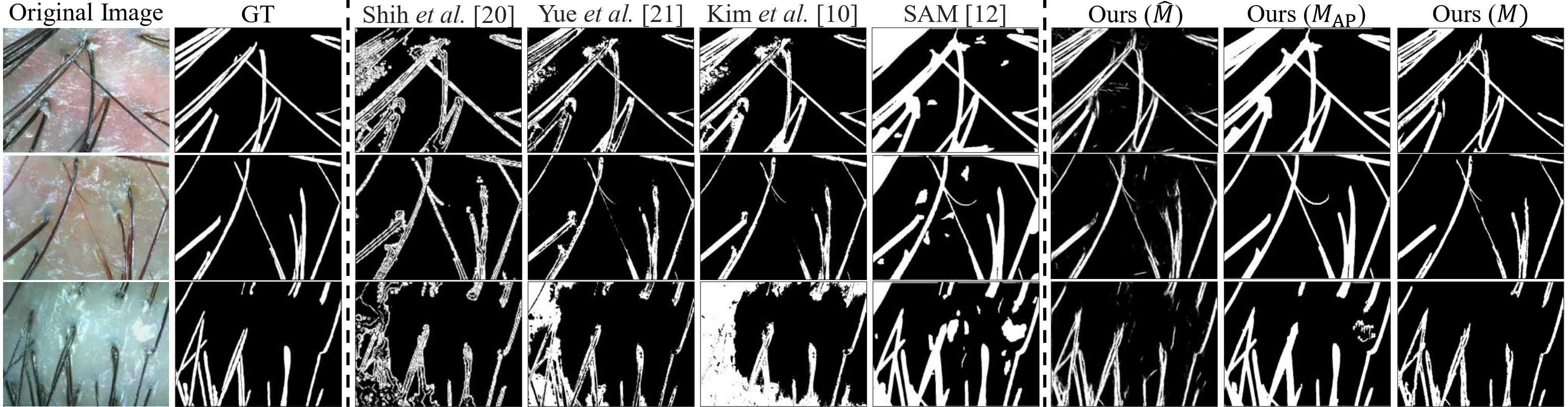 segmentation comparision